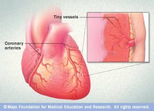 heart small vessel disease